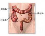 結腸閉鎖