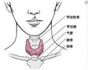 亞急性甲狀腺炎 亞急性甲狀腺炎