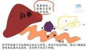 甲型肝炎