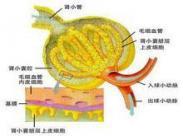 局灶性腎小球硬化癥