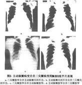 二尖瓣和主動脈瓣的疾患