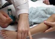 小兒腓骨肌萎縮癥 小兒腓骨肌萎縮癥