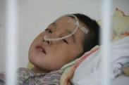 散發(fā)性腦炎 散發(fā)性腦炎