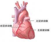 冠狀動脈終止異常 冠狀動脈終止異常